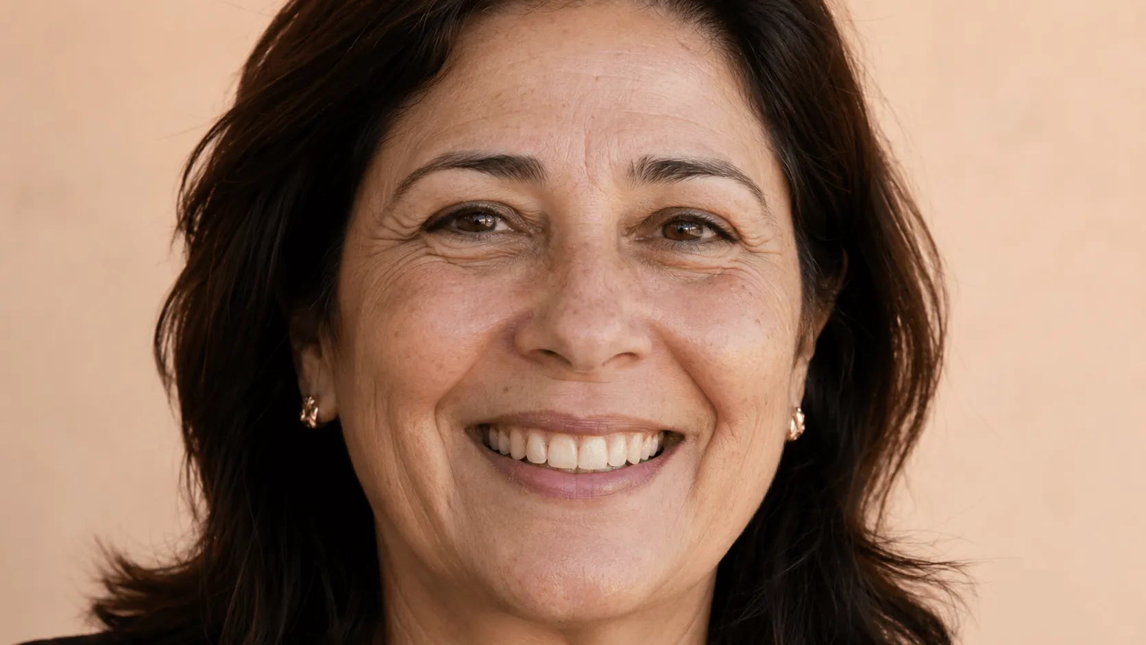 Caso 4 antes, dentes envelhecidos com manchas