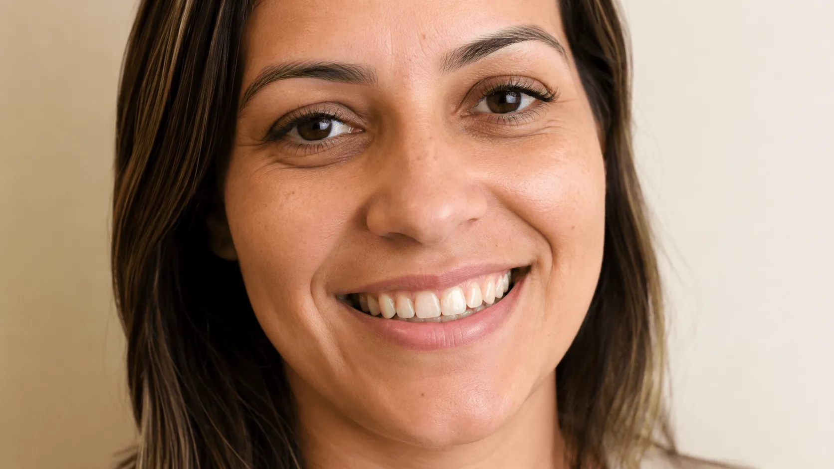 Caso 6 antes, dentes irregulares e assimétricos