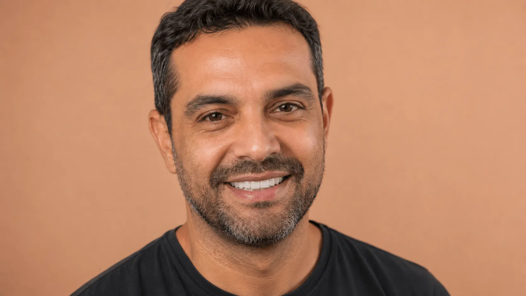 Caso 2 depois, dentes restaurados com proporção natural