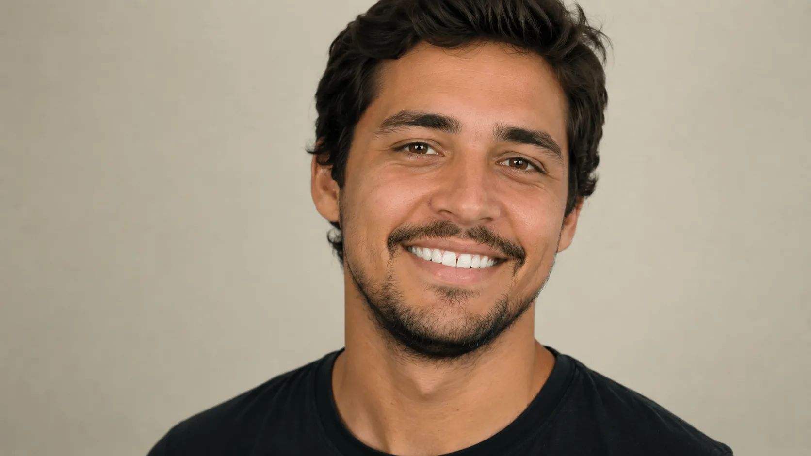 Caso 5 depois, dente reconstruído com lente de contato dental