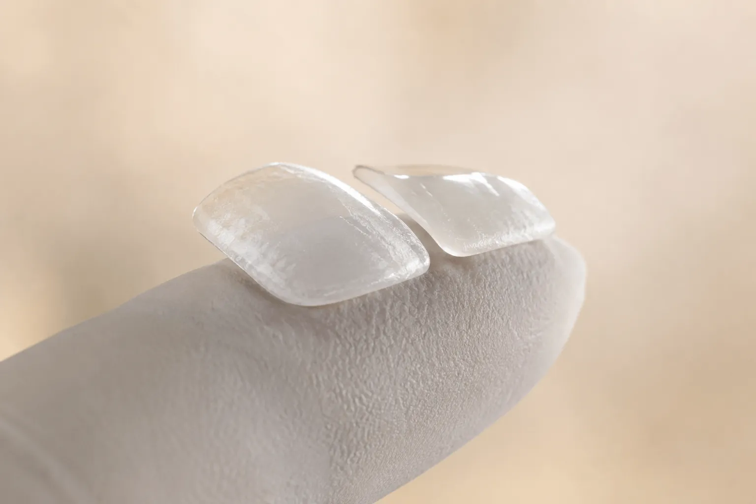 Lentes ultrafinas de porcelana sobre dedo enluvado mostrando translucidez